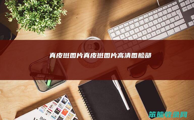 真皮斑图片真皮斑图片高清图脸部