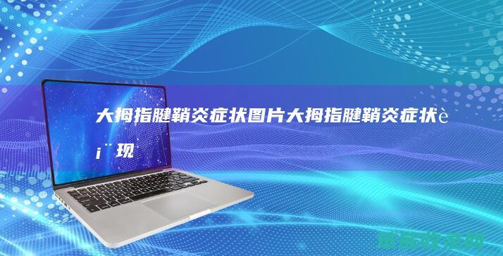 大拇指腱鞘炎症状图片（大拇指腱鞘炎症状表现）